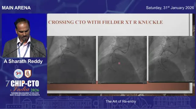 Clear lecture slide 'CROSSING CTO WITH FIELDER XT R KNUCKLE' showing three high‑contrast angiographic panels; central/right panel includes a marked target point where a retrograde balloon would protect the distal true lumen; presenter at podium left.