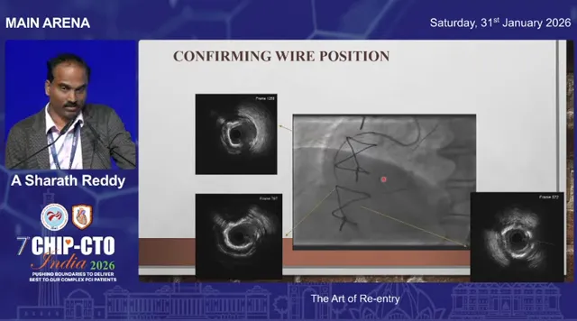 Presentation slide titled 'Confirming wire position' showing a central angiographic image of knuckled wires with adjacent intravascular ultrasound cross‑sections, demonstrating confirmation of true‑lumen wire position.