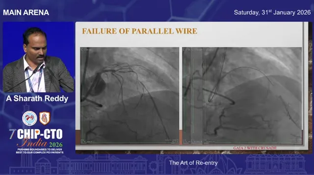High-clarity presentation image of two angiographic views showing failed parallel-wire technique with visible subintimal wire tracks and device outlines; presenter visible at left.