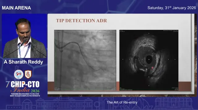 Clear conference slide showing a left-panel coronary angiogram and a right-panel IVUS cross-sectional image used to demonstrate IVUS-guided tip detection in antegrade dissection and re-entry (ADR).