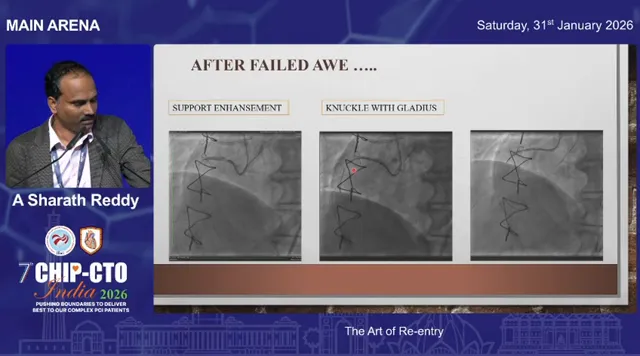 Clear slide image with three angiographic panels; central panel highlights a gladius knuckle traversing the subintimal plane used before re-entry.