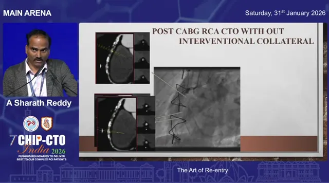 Conference slide with CT axial slices on the left and a central angiogram image highlighting a target re‑entry zone for a post‑CABG RCA CTO.