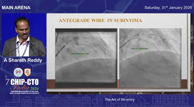Presentation slide titled 'ANTEGRADE WIRE IN SUBINTIMA' with two clear angiographic panels demonstrating subintimal wire tracks and labels.
