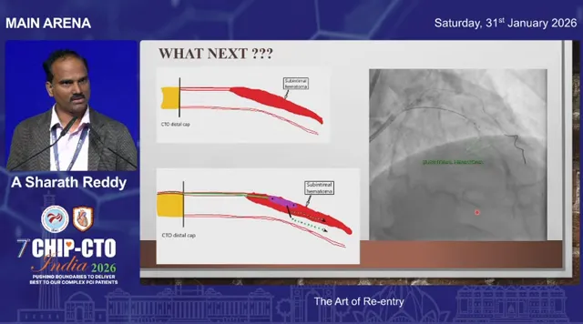 Lecture slide titled 'WHAT NEXT ???' with left-side schematics showing subintimal dissection/hematoma and a right-side angiographic image illustrating a subintimal hematoma; presenter visible at left (speaker not identified).