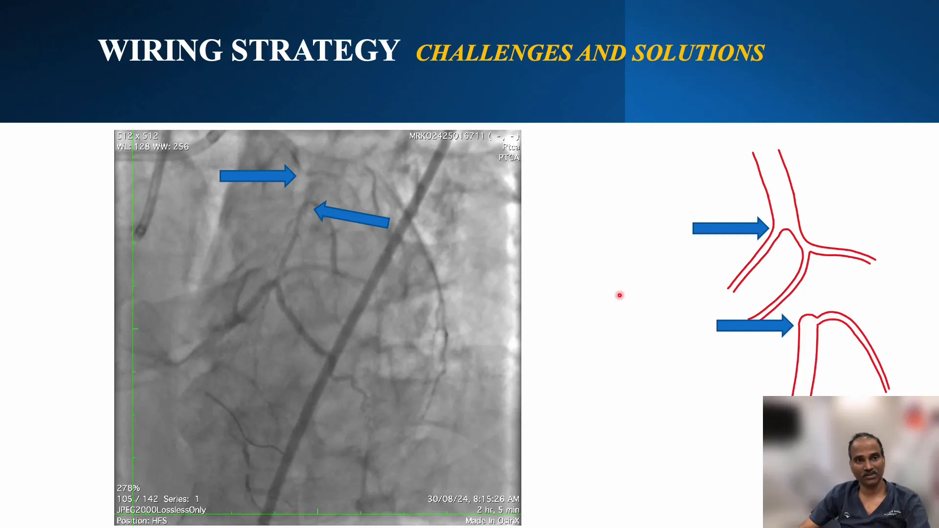 Evaluation of the diagonal branch angle and origin