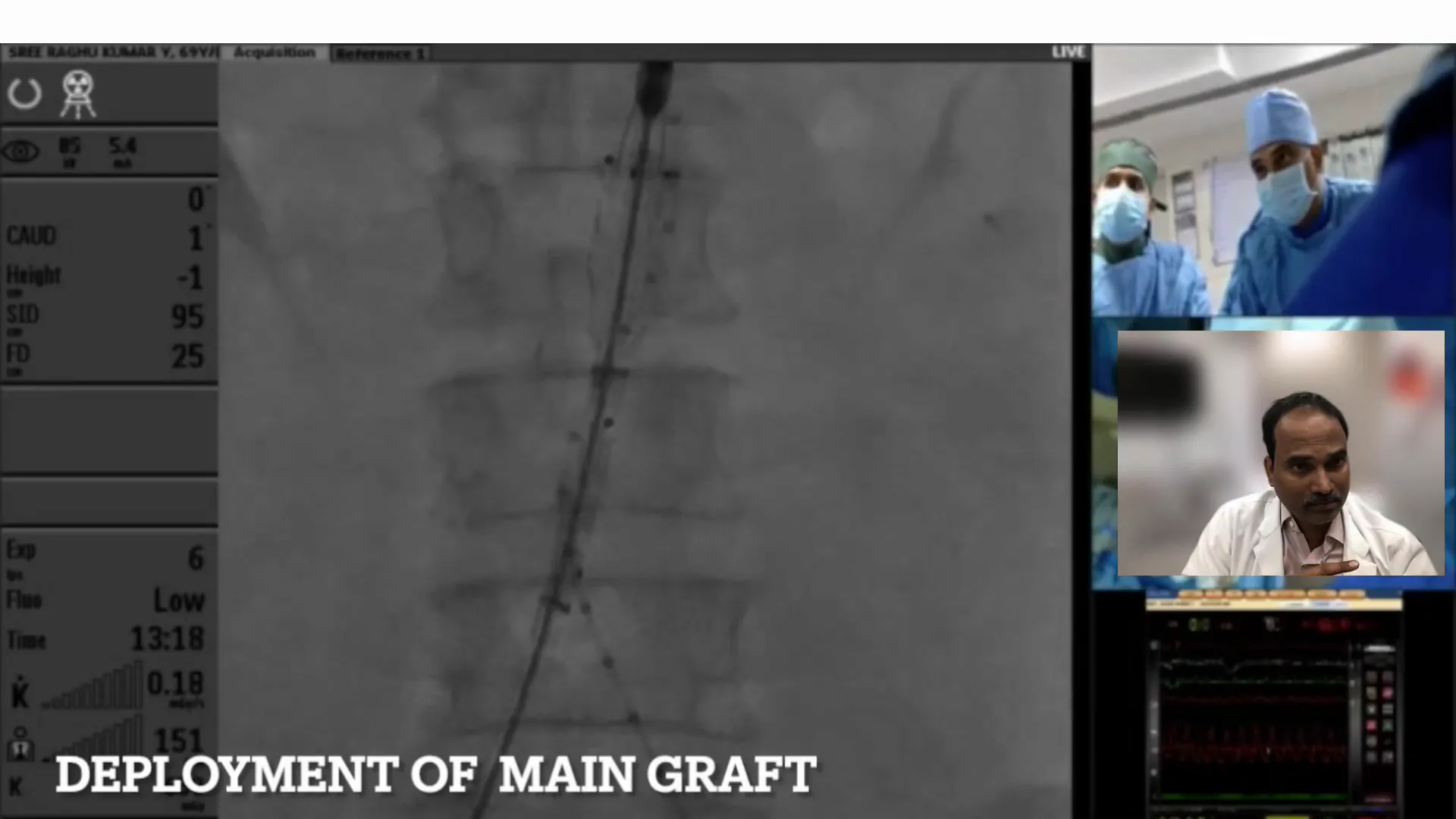 Graft deployment markers within aneurysm