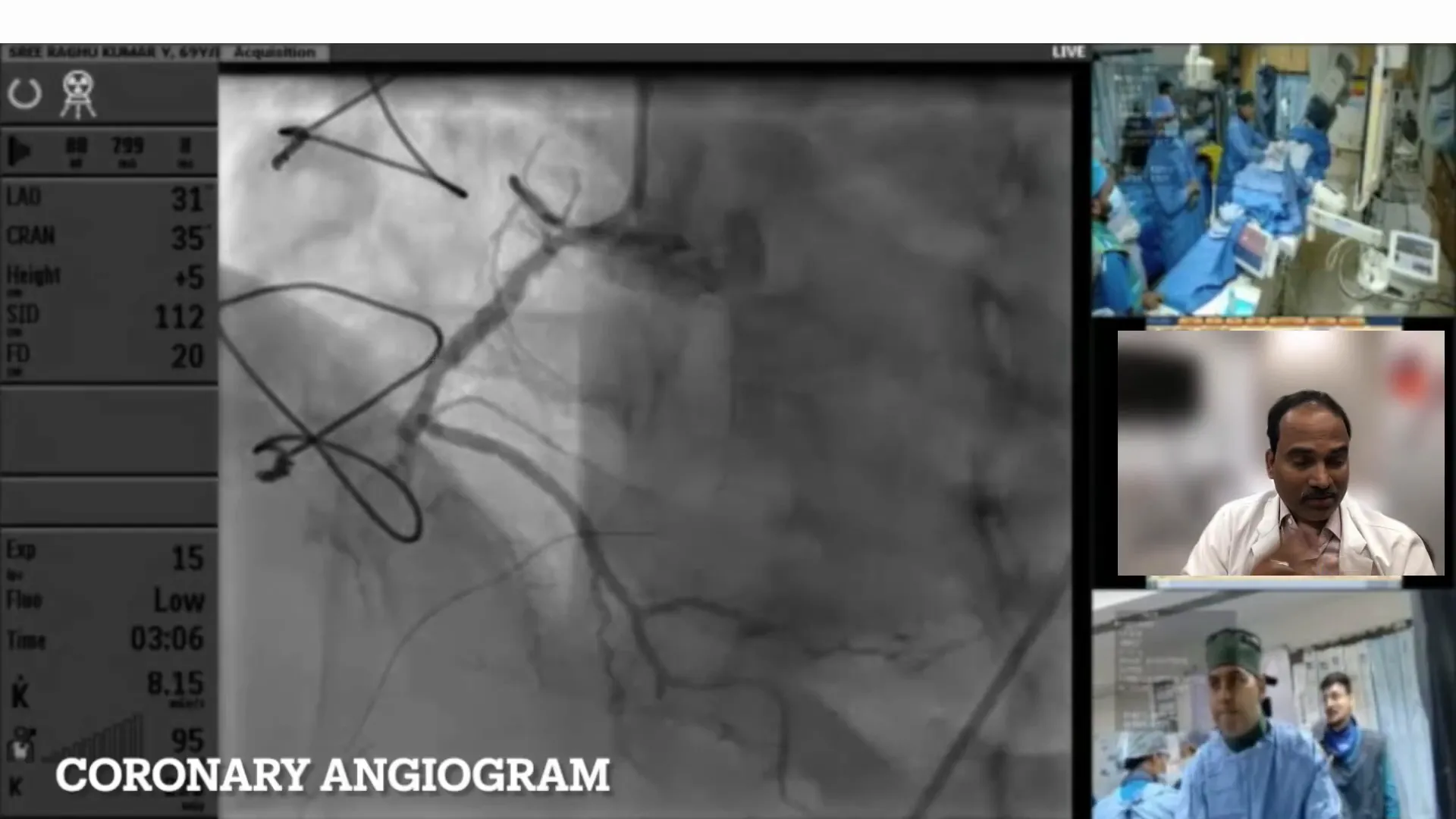 Coronary angiogram showing occlusion