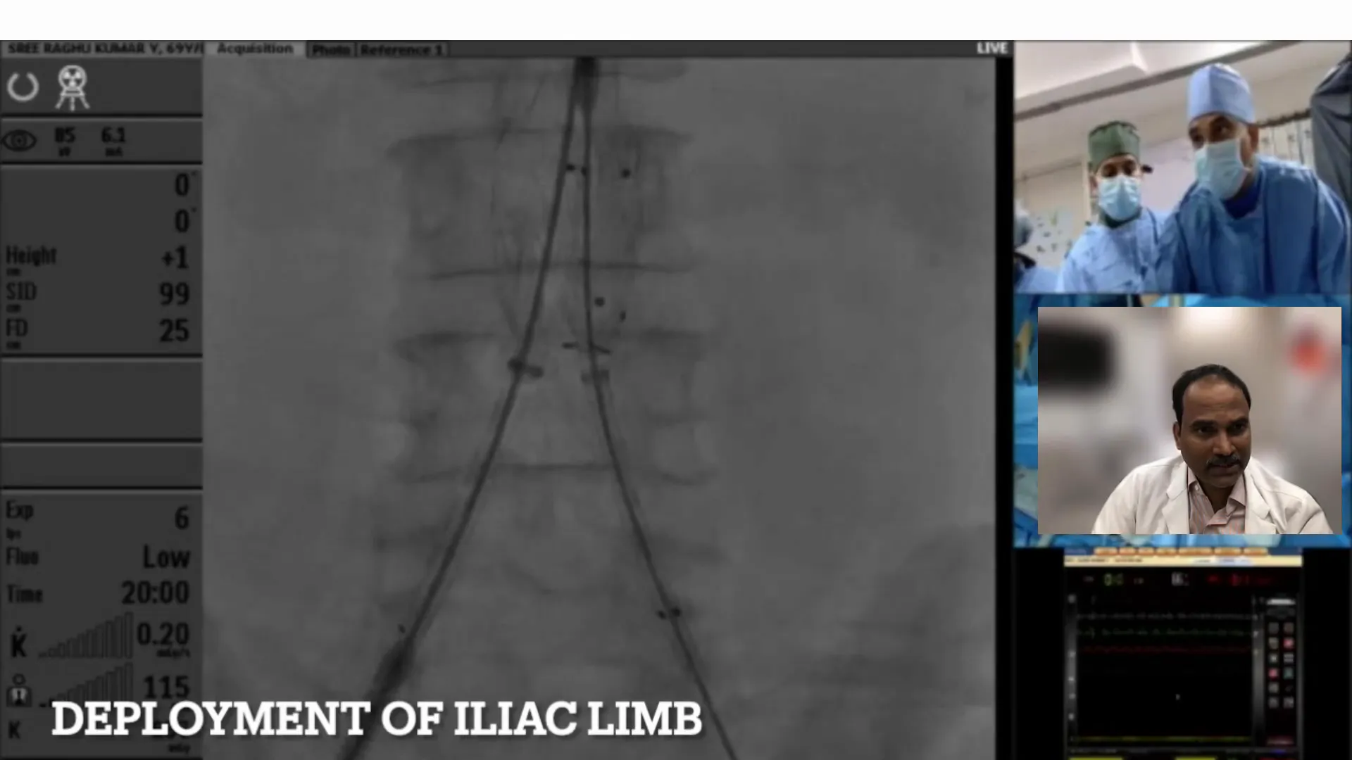 Final positioning and deployment of graft