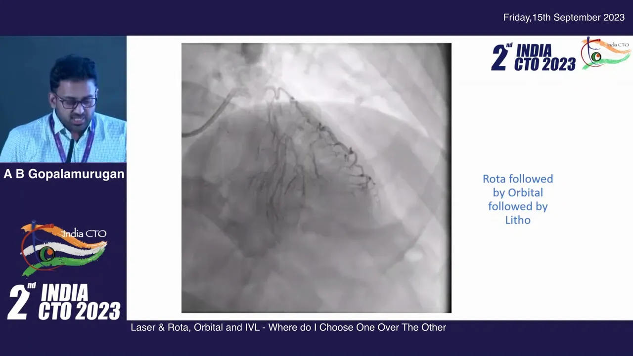 Left main coronary lesion with calcification and shadowing