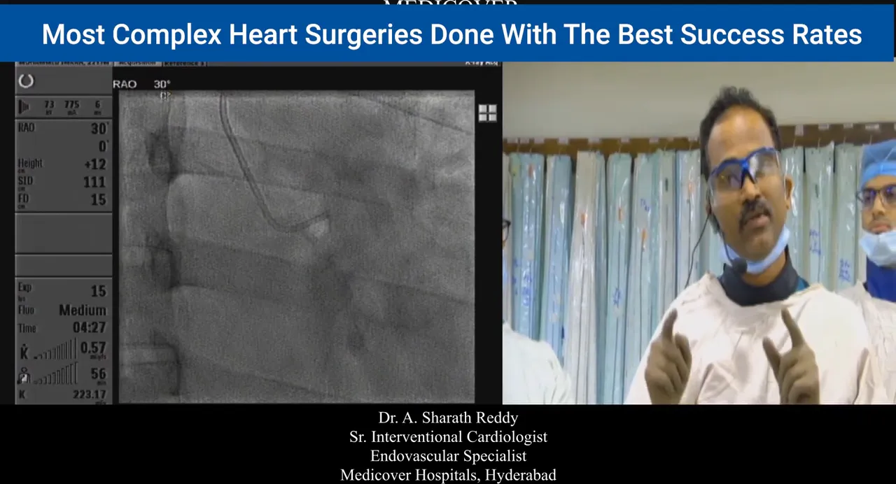 RAO fluoroscopic image of catheter in left coronary sinus with operator demonstrating gentle technique