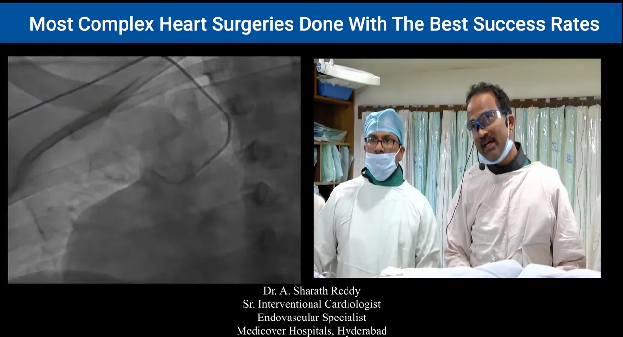 Fluoroscopic angiogram with clearly visible catheter curve and guidewire alongside operators in split-screen