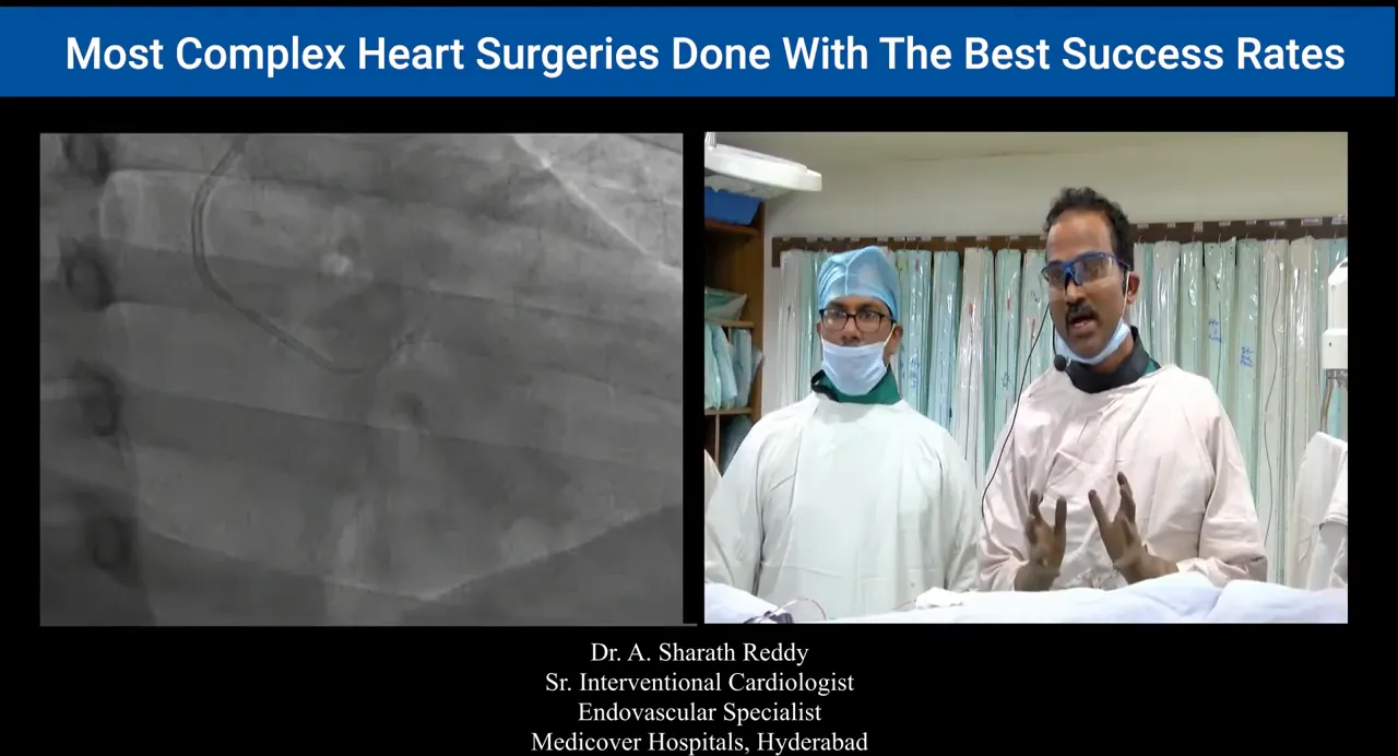 Fluoroscopic RAO view showing catheter curve in the sinus with operator gesturing on right