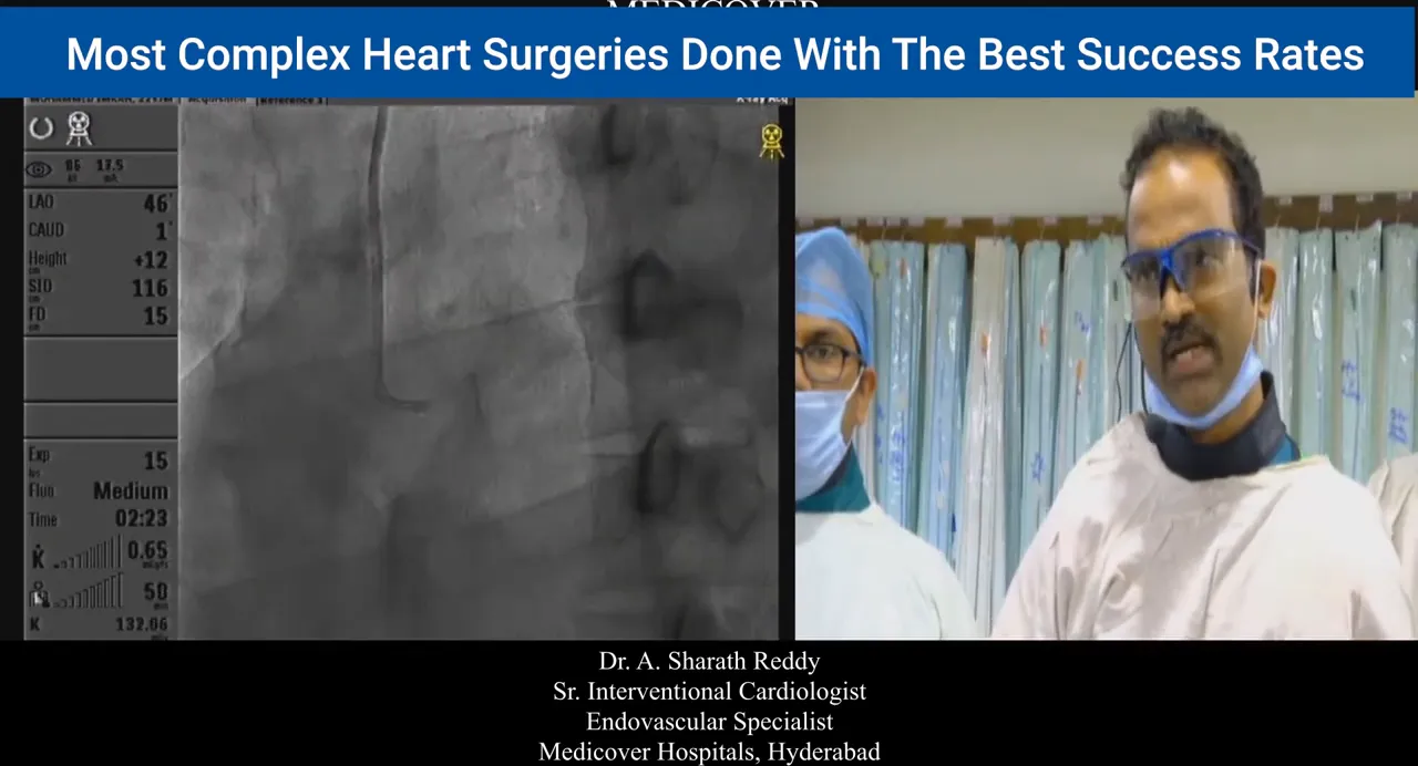 Fluoroscopic image showing catheter tip in left coronary sinus with presenter at right