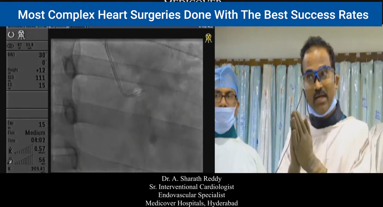 Split-screen fluoroscopy showing catheter tip engaging the left coronary sinus with clinician at right for context