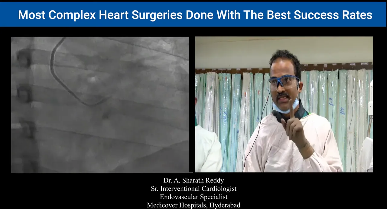 Fluoroscopic frame showing a non-selective coronary sinus injection with catheter outline and presenter gesturing