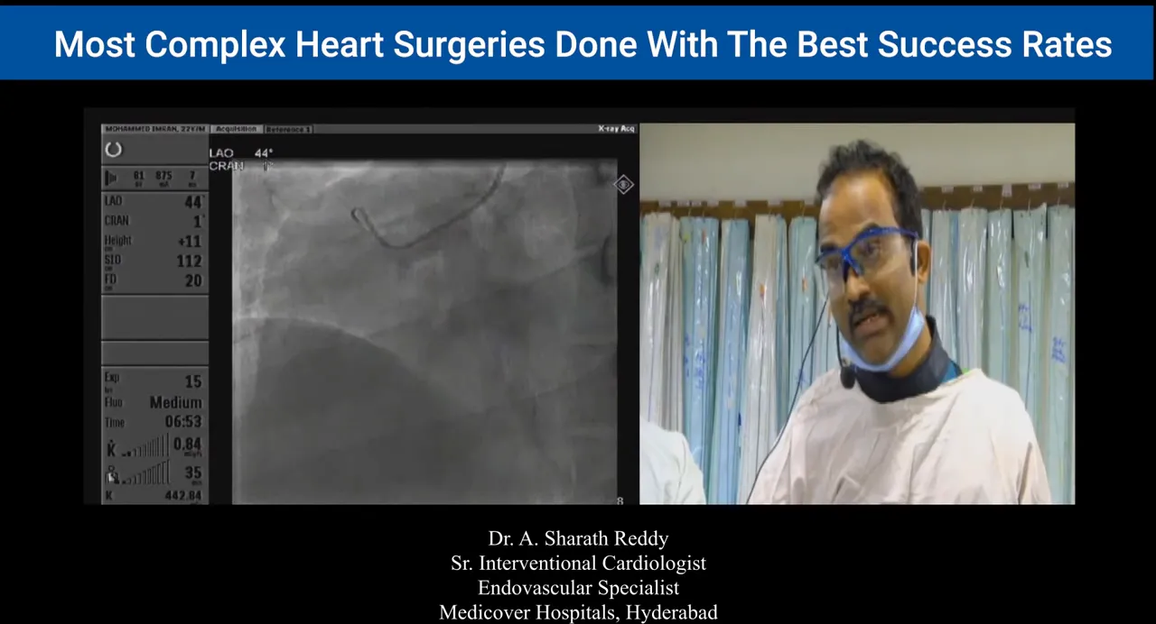 High-clarity fluoroscopic angiogram showing a catheter tip and curve in the coronary sinus with an operator visible on the right