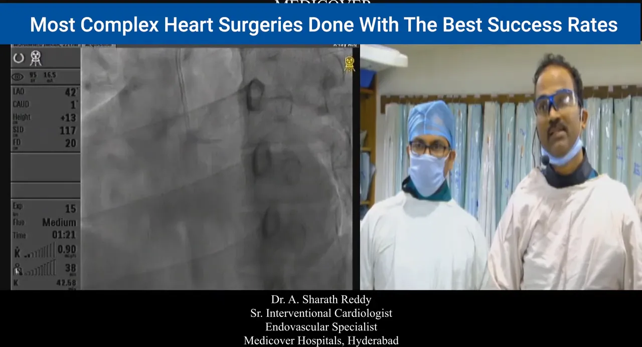 Fluoroscopic image of left coronary angiogram showing catheter tip engaged at the left coronary ostium with procedural team at the right
