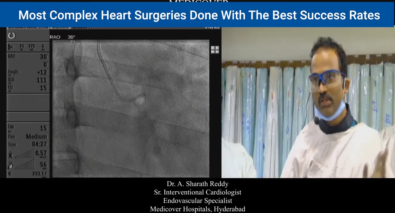 High-clarity fluoroscopic image showing catheter tip and curve in the coronary sinus with presenter at right