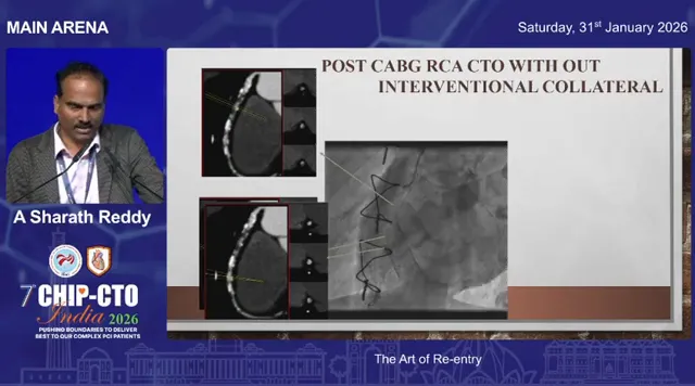 Lecture slide with CT axial images and central angiogram marking the re-entry site in an RCA CTO