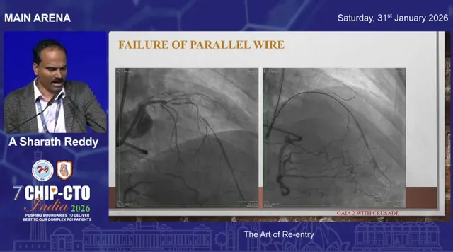 Clear conference slide with dual angiographic images titled 'Failure of parallel wire' showing subintimal wire tracks