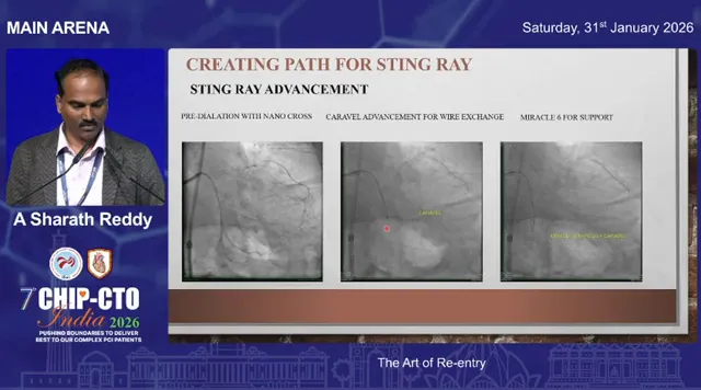 Clear presentation slide showing pre-dilation, microcatheter advancement, and support options for Stingray delivery