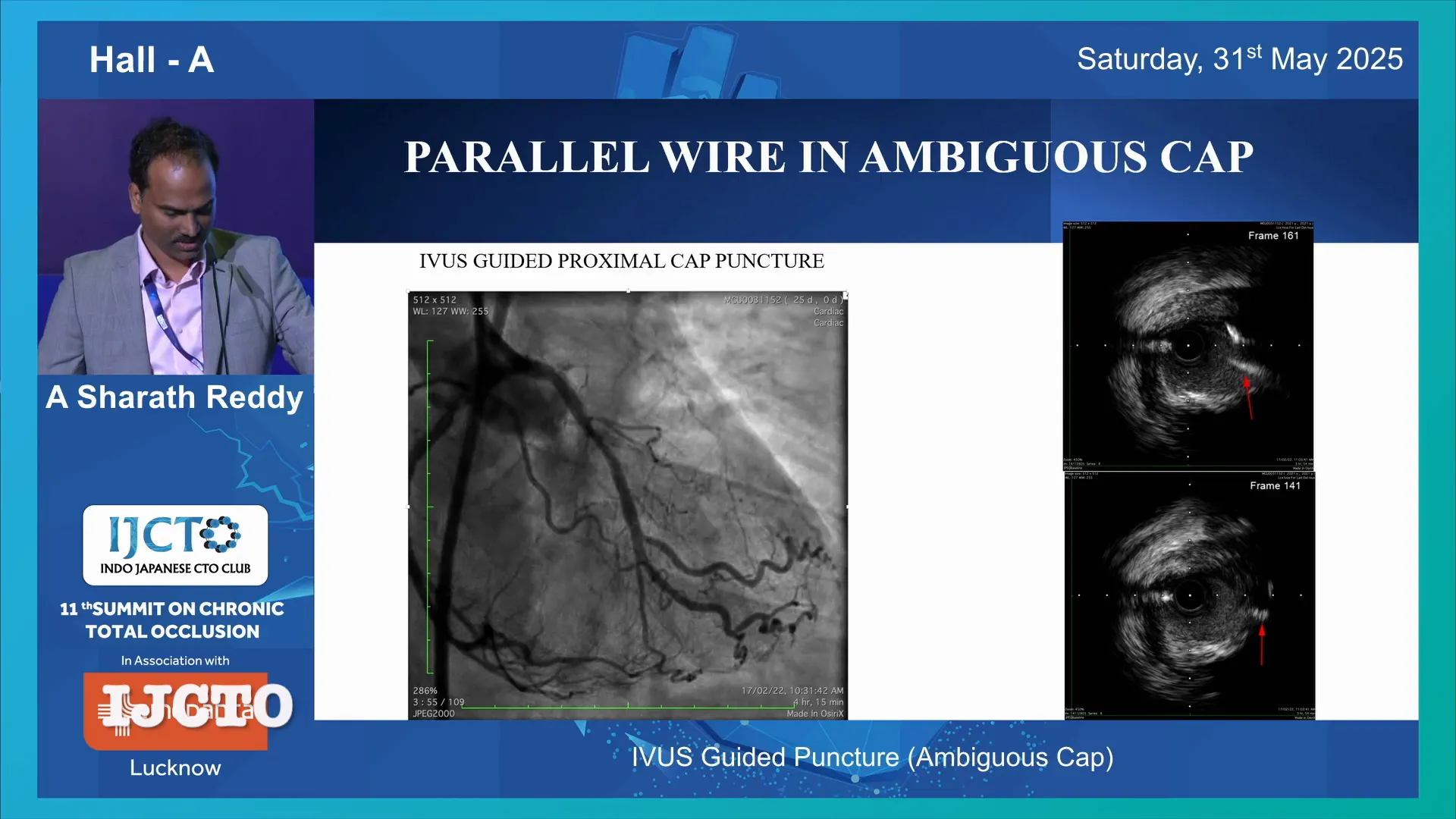 Retrograde cap puncture with IVUS guidance