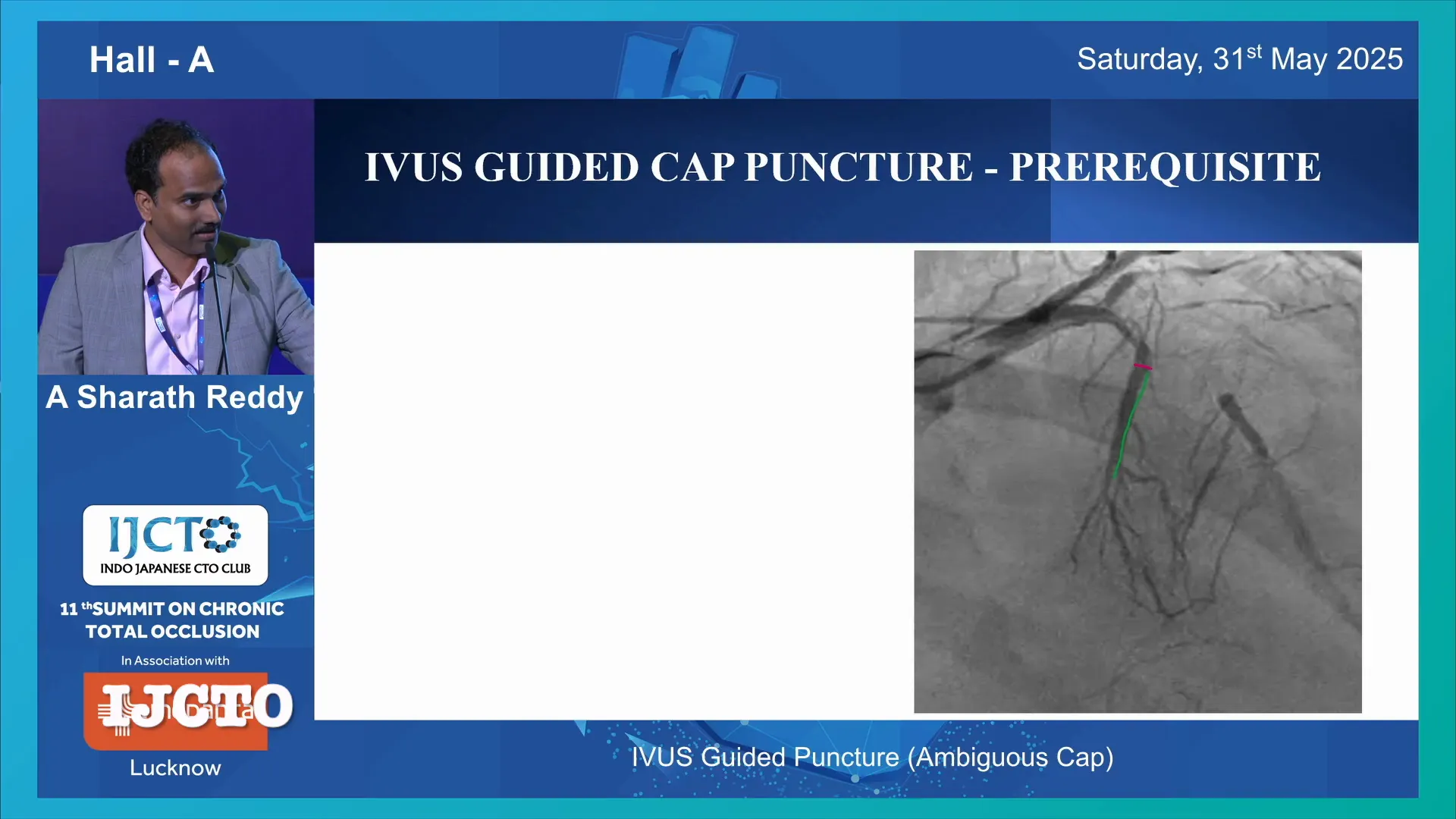 IVUS catheter in side branch with optimal angulation
