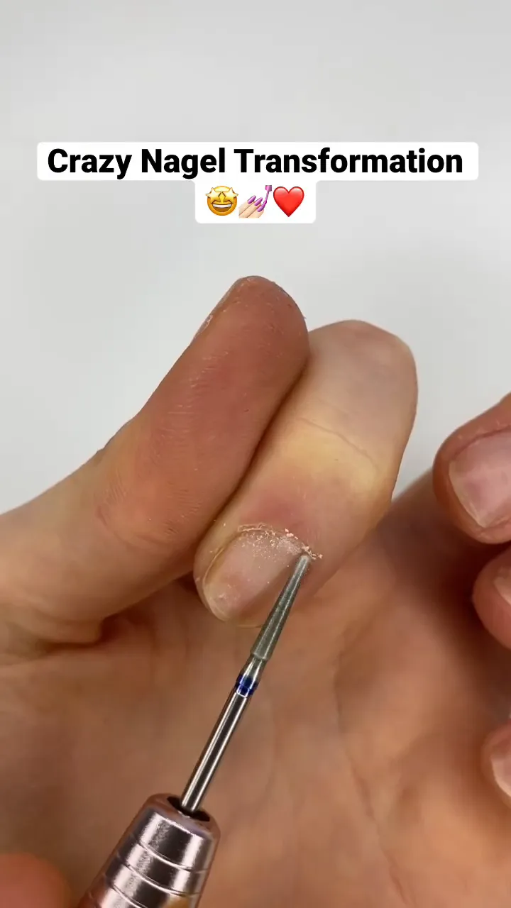 Nagelhaut entfernen