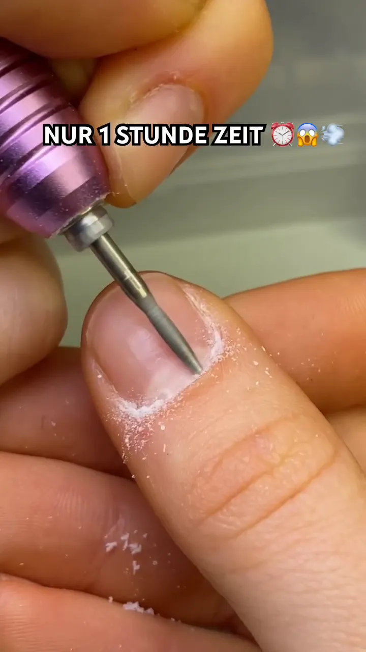 Nagelhaut entfernen und Nagel anrauen