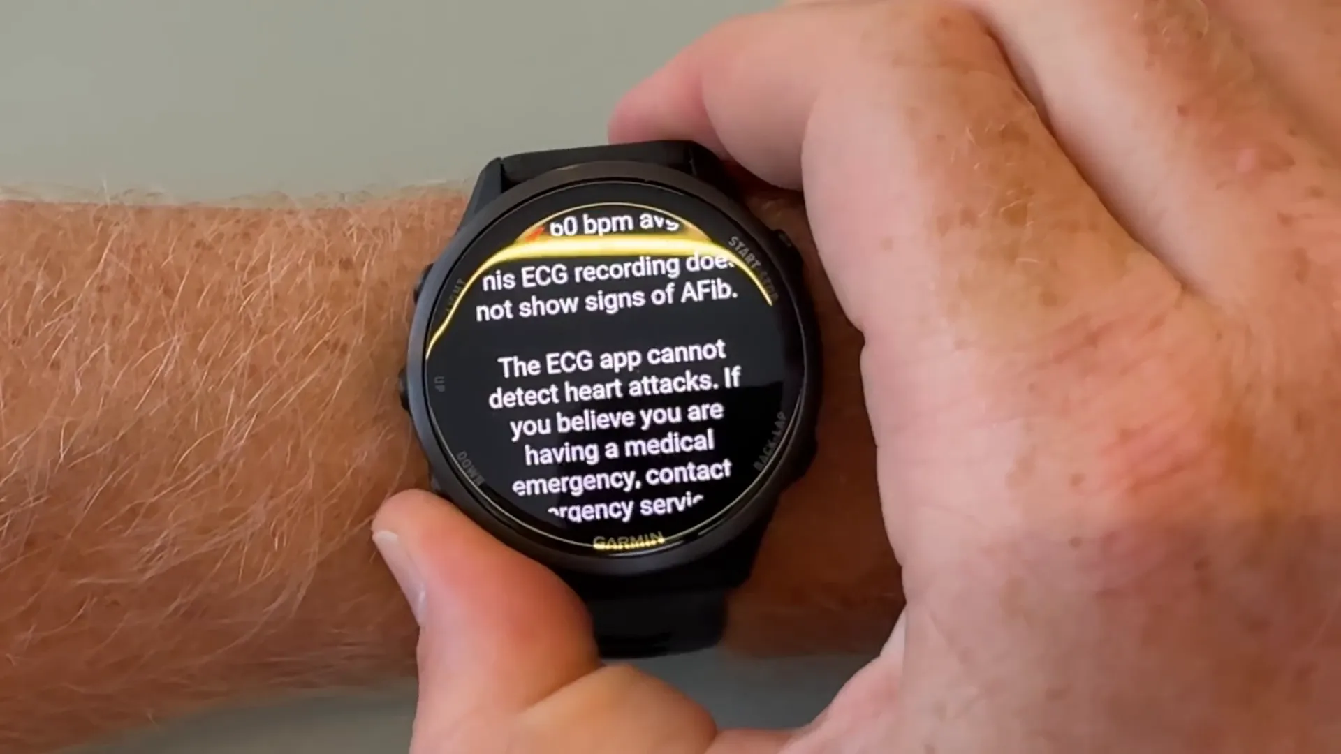 ECG feature on Garmin Forerunner 970