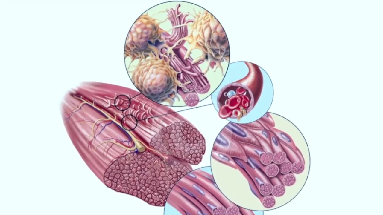 Ice stops the flow of macrophages, hindering healing