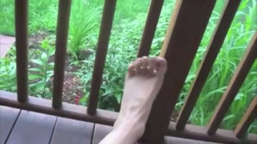 Day two ankle showing improved color and mobility