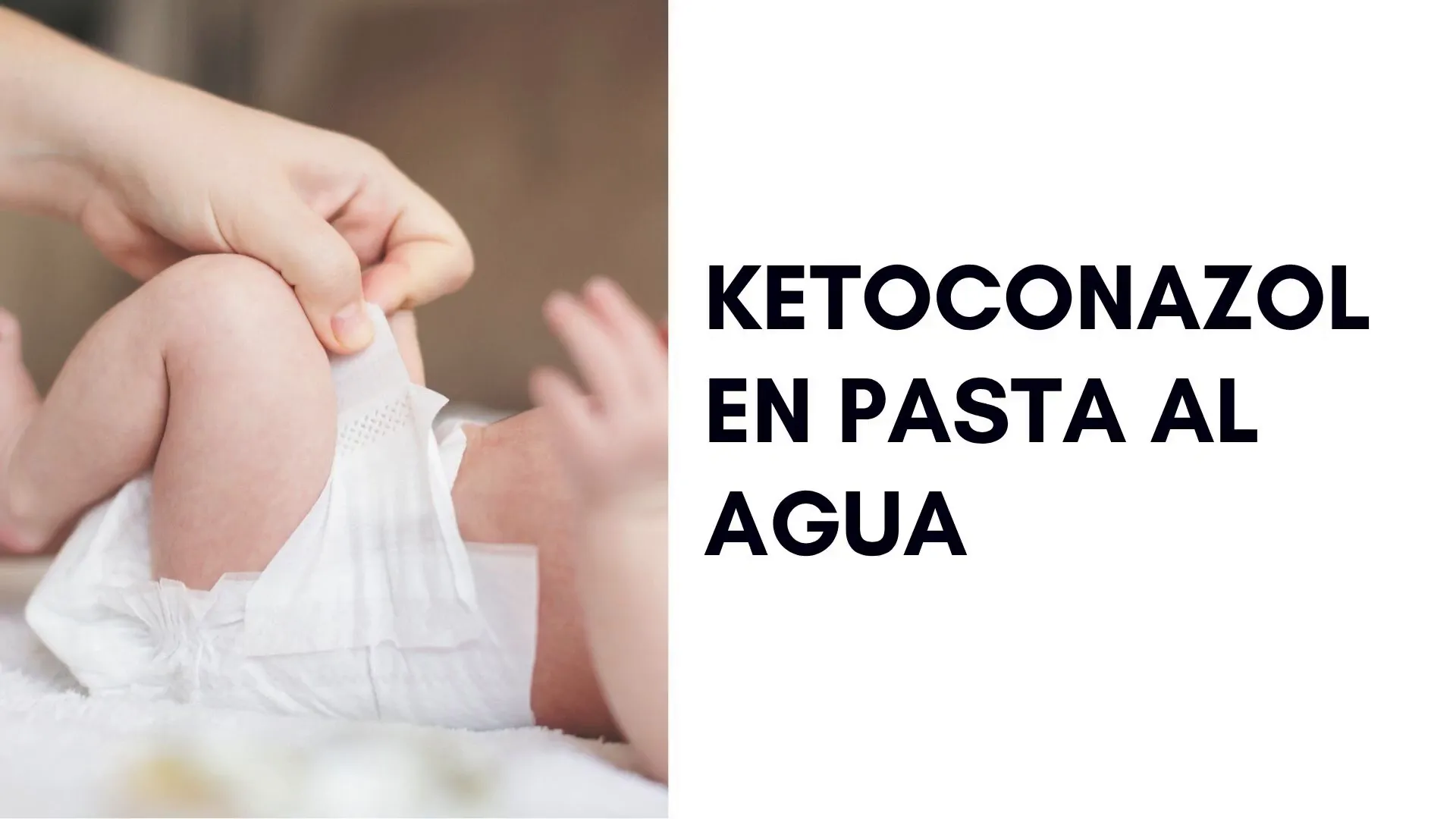 Introducción al tratamiento de dermatitis del pañal con ketoconazol