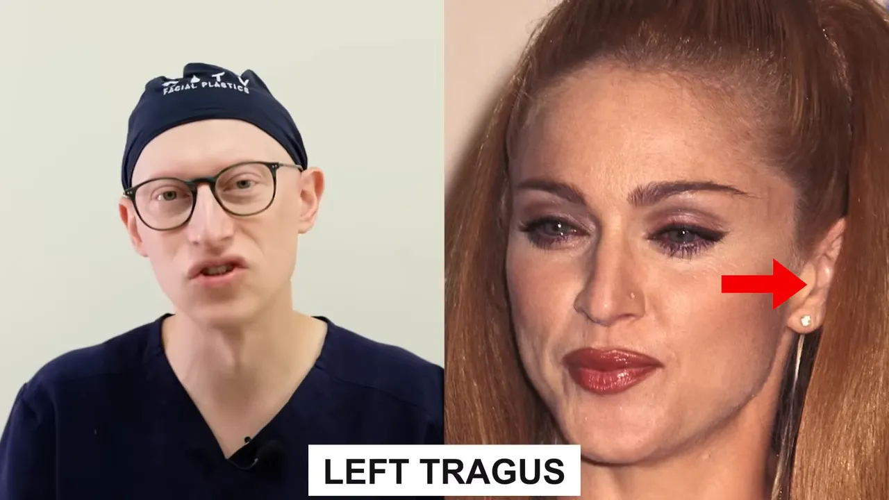 Imagem dividida: especialista falando à esquerda; à direita retrato com seta vermelha apontando a área anterior à orelha (tragus)