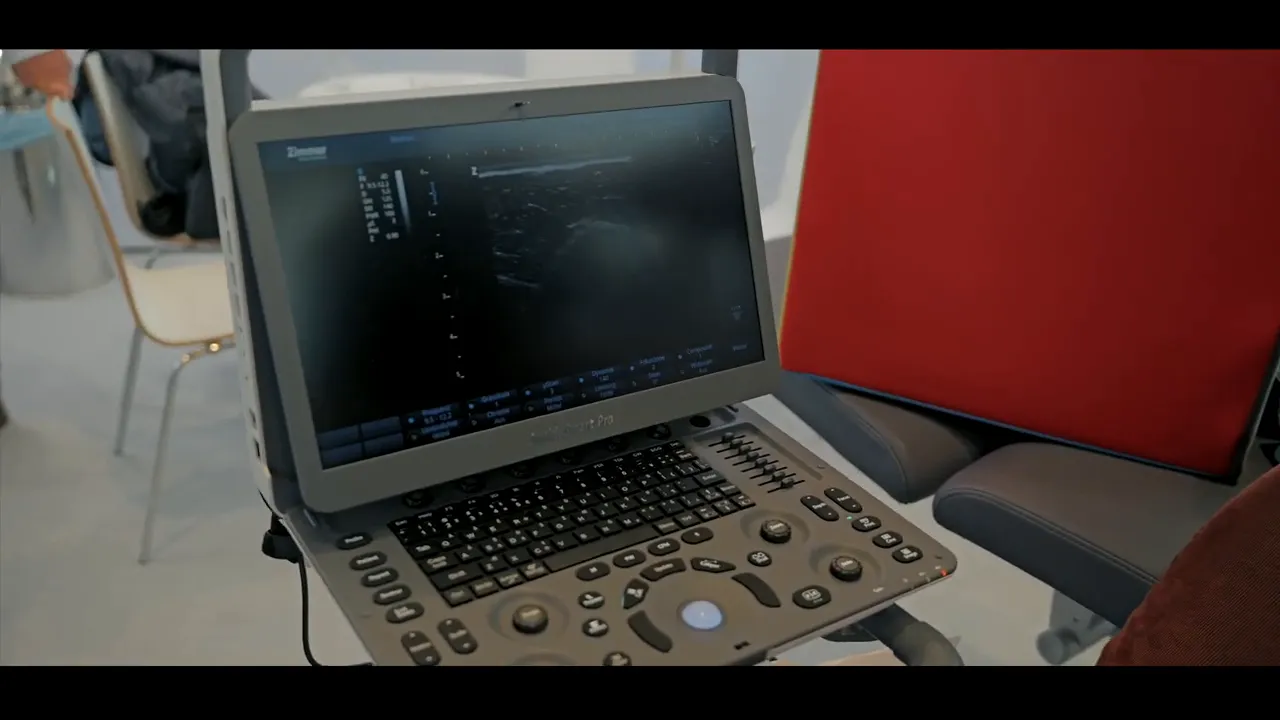 Sonido Smart Pro Bildschirm mit Ultraschallbild