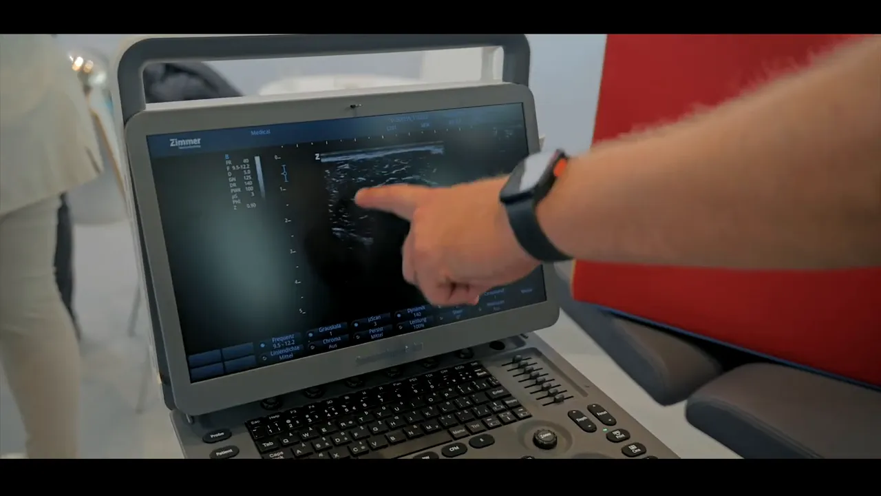 Finger deutet auf den Sonido Smart Pro Monitor, der ein detailliertes Ultraschallbild zeigt.