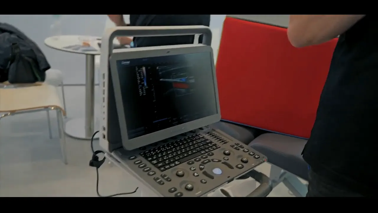 Ultraschallmonitor des Sonido Smart Pro zeigt Farbdoppler-Bild