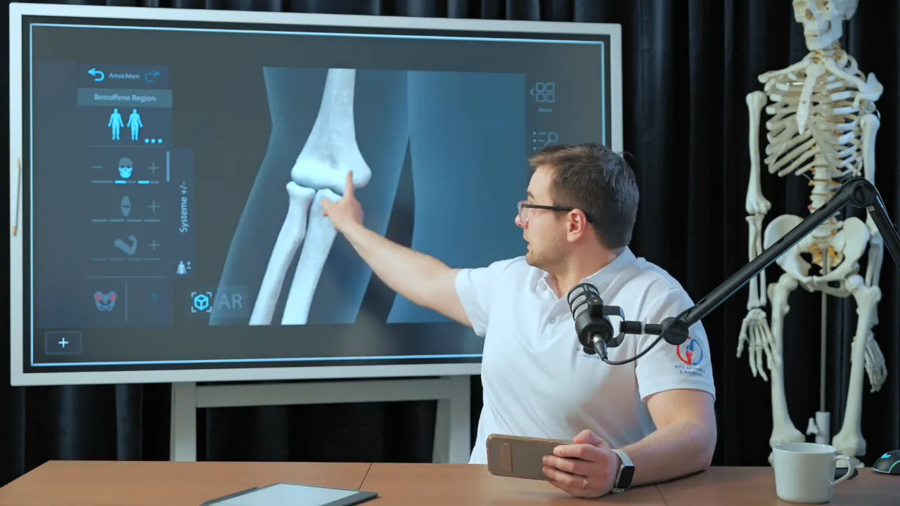 Sprecher zeigt auf Bildschirm mit vergrößertem Ellenbogenknochen