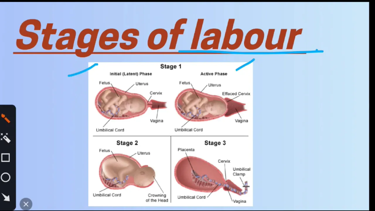 Normal Labour Explained: A Step-by-Step Guide to Signs, Stages and Progress Obstetric illustrations showing cervical opening, birth of the baby and delivery of the placenta