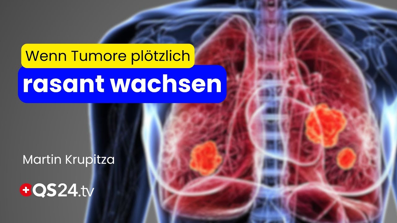 video thumbnail for 'Turbokrebs – wenn der Körper plötzlich gegen sich selbst kämpft | Naturmedizin | QS24'
