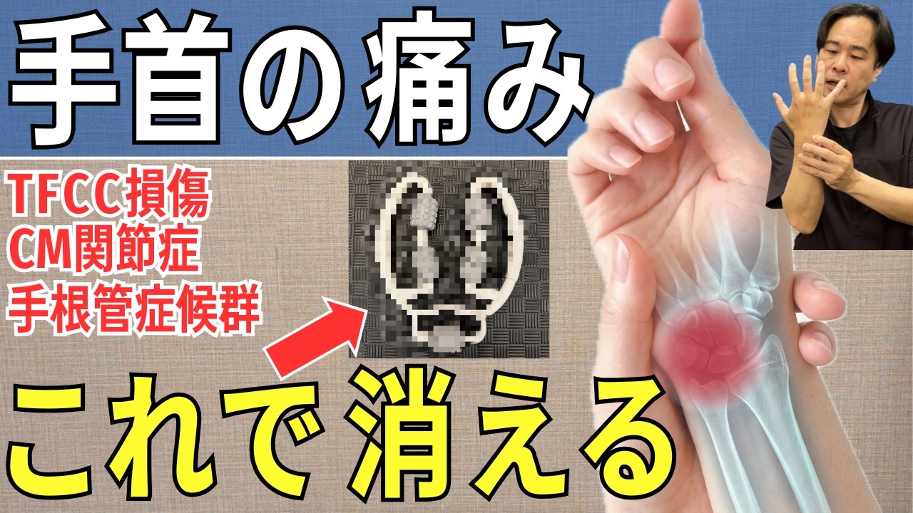 video thumbnail for '【TFCC損傷】手遅れになる前に…たった200円で手首の痛みが楽になる簡単セルフケア  |  大阪市都島区 さかとう整骨院'