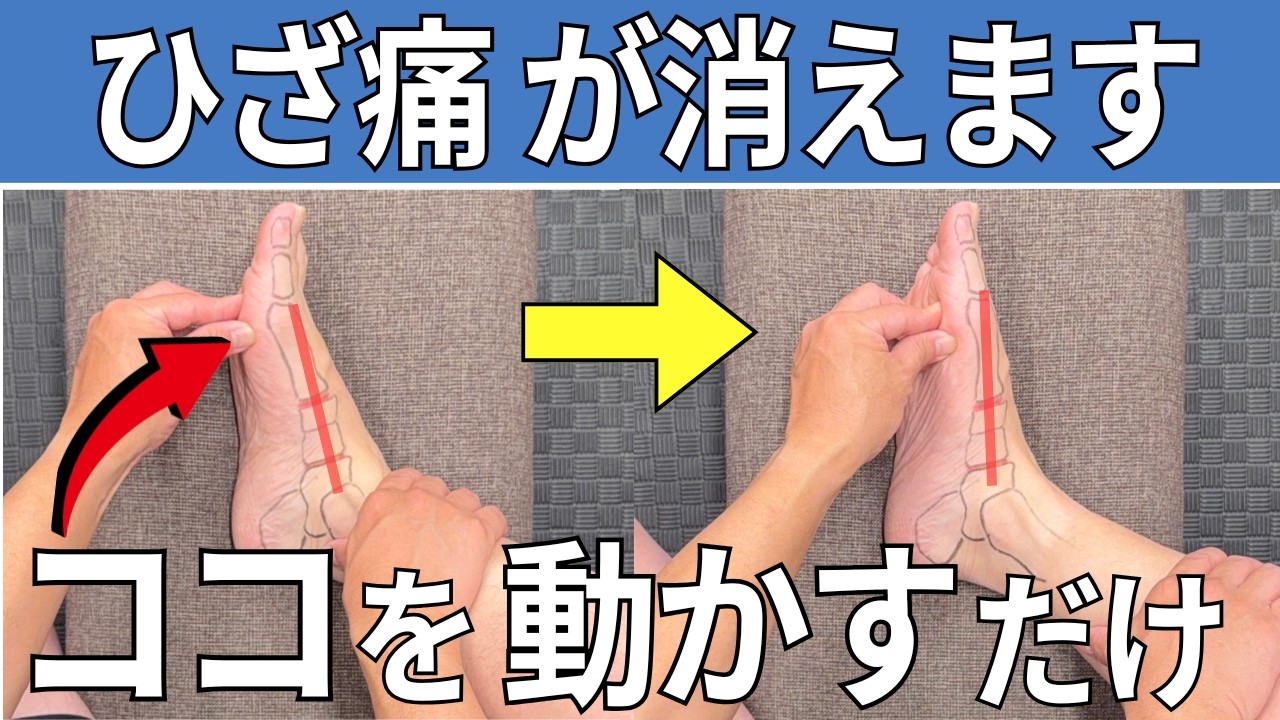 video thumbnail for 'ひざ痛はここが動かないと治りません。「親指」を押してみて動くかチェックして下さい  |  大阪市都島区 さかとう整骨院#156'