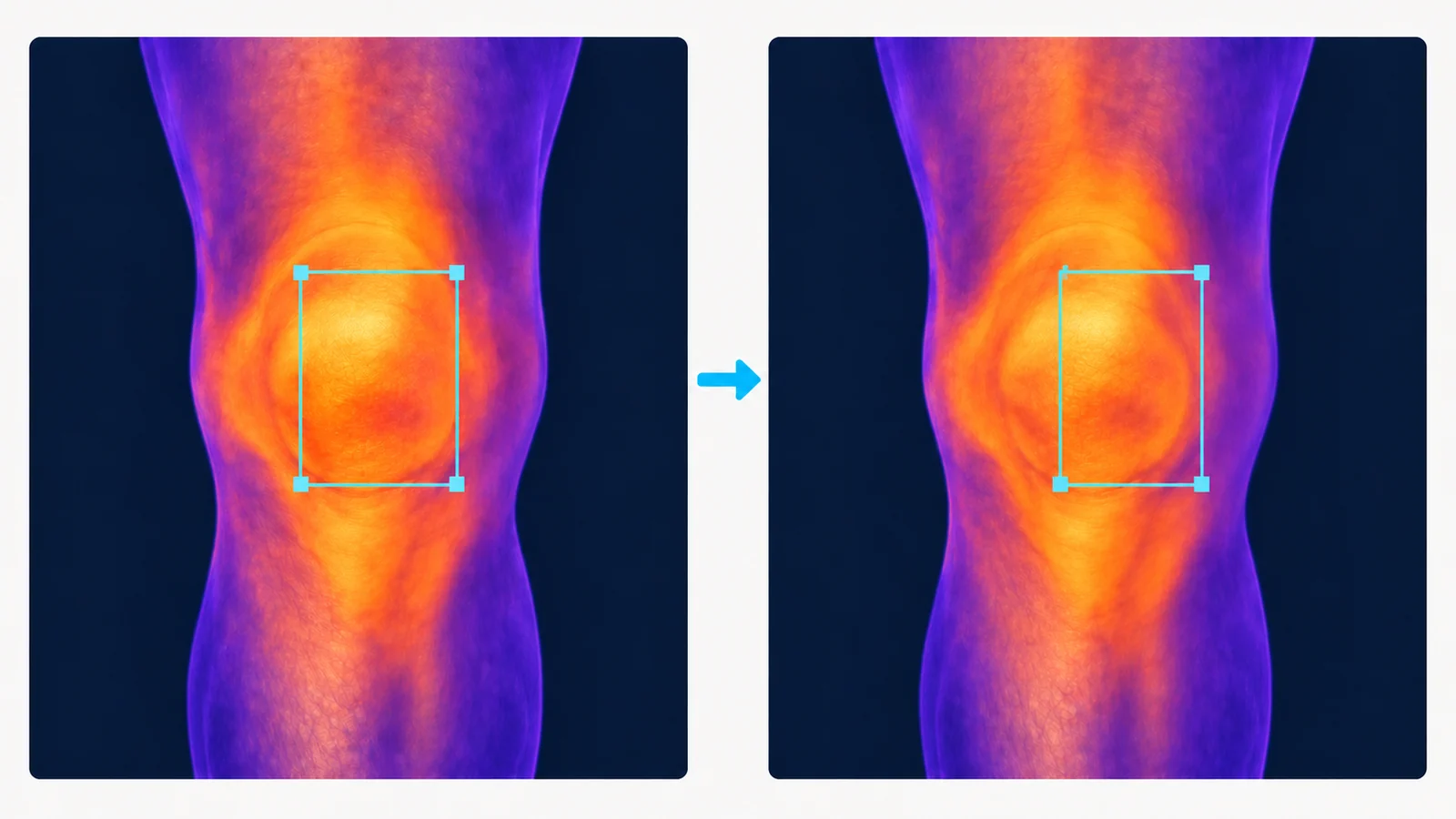 The same conceptual knee thermogram in two panels, with a region of interest shifted toward cooler peripheral skin in the second panel.