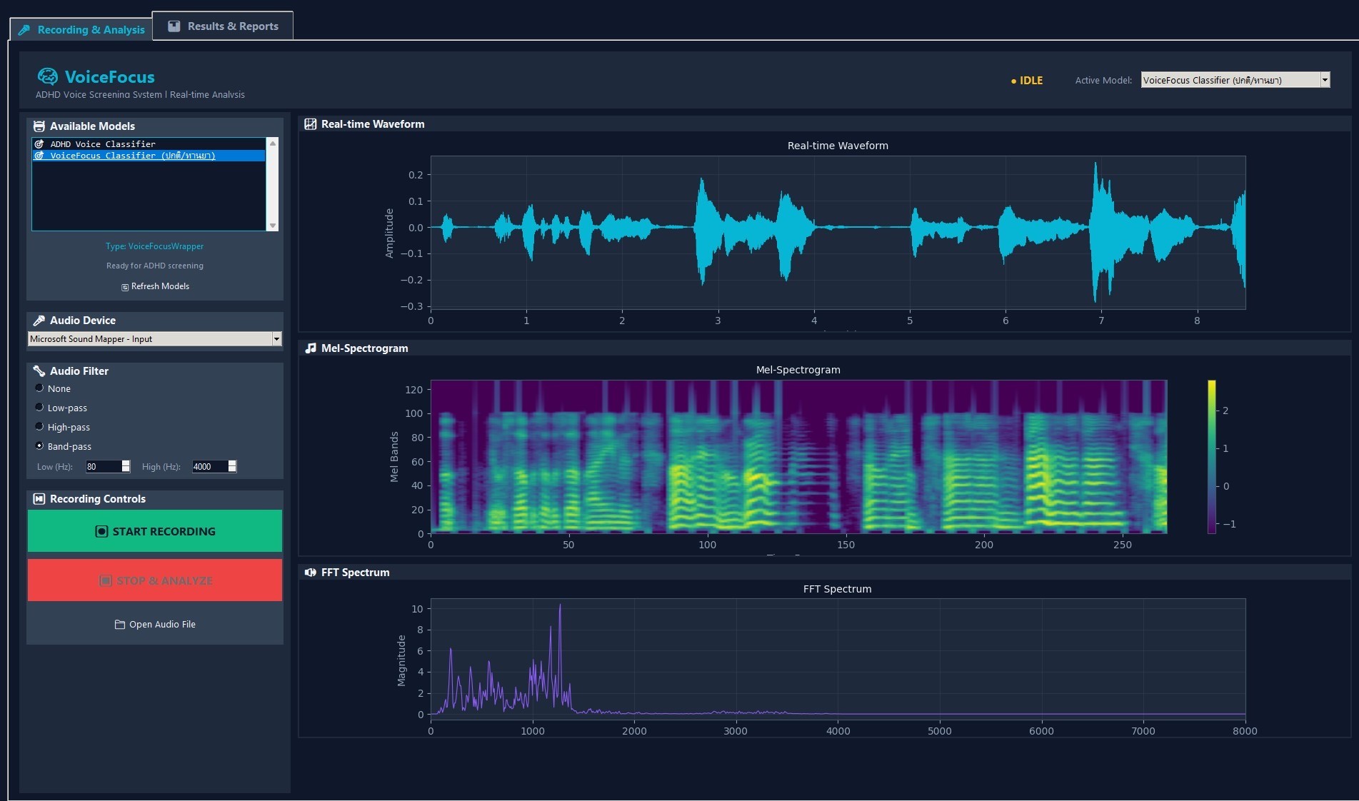 NeuroScreen Pro — Recording and Analysis Interface
