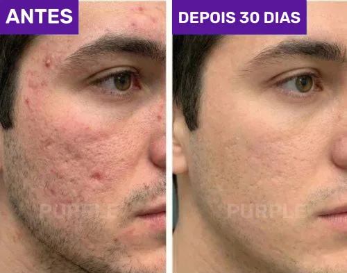 compressed_1770651018920_inserir-um-titulo-25.png.webp?alt=media&token=vtk_kHpsyYPPYwPYtseOLa7izDjFq4n2