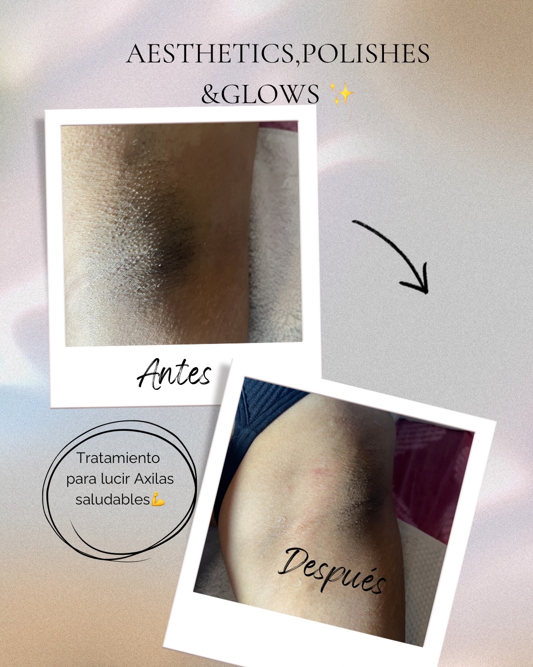 Aesthetics,Polishes&Glows