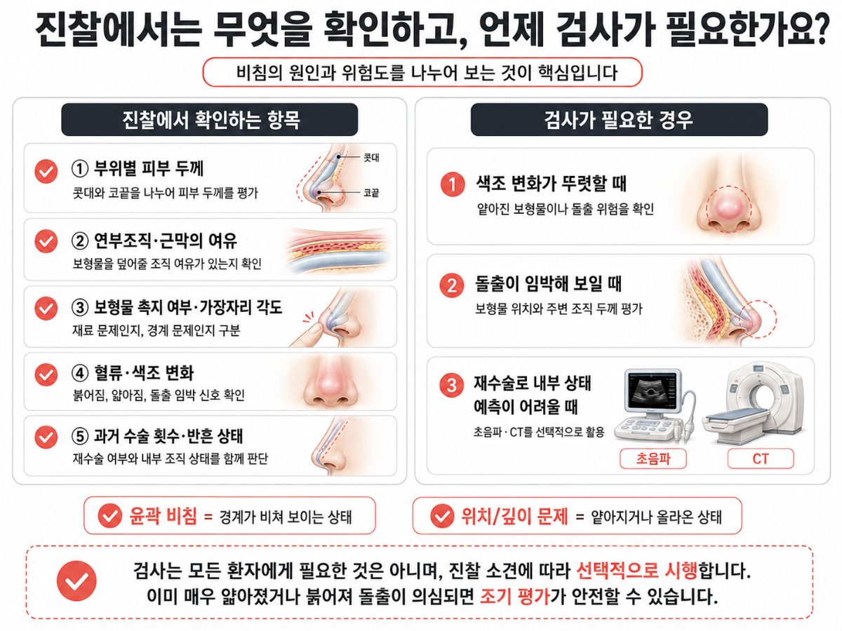 Why Does a Nasal Implant Show Through Thin Nose Skin?