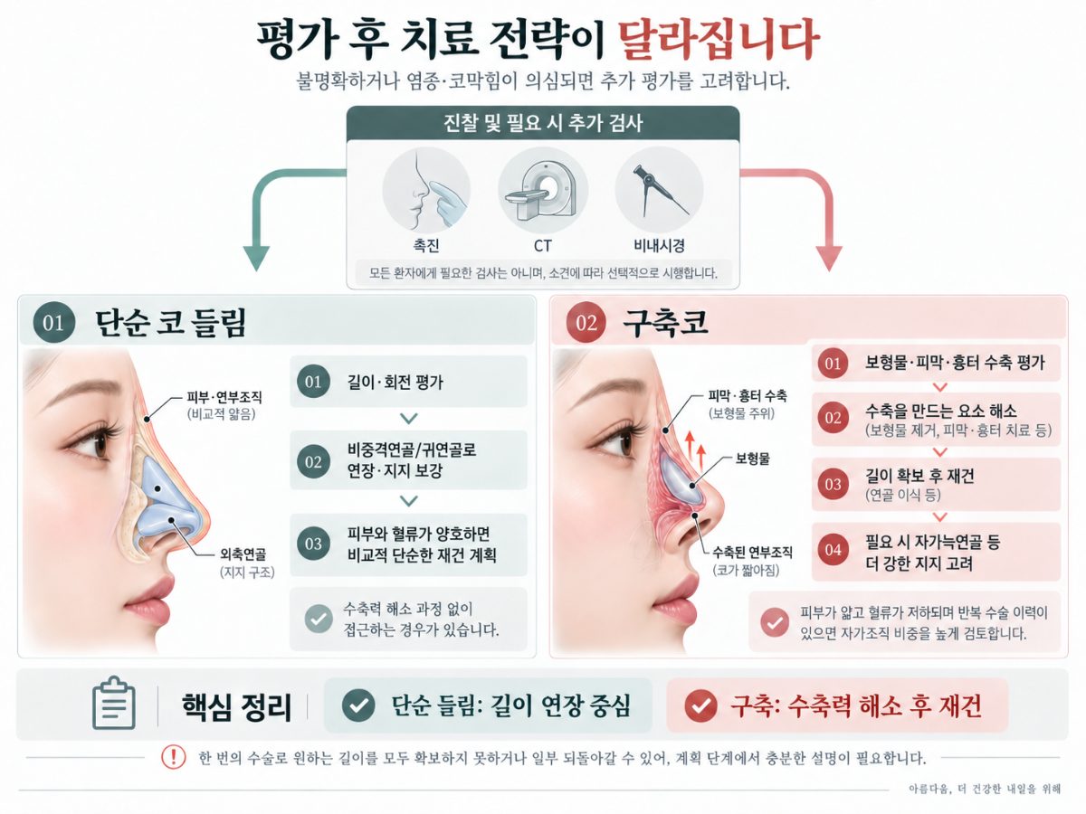 How Can You Tell a Simply Upturned Nose from a Contracted Nose?