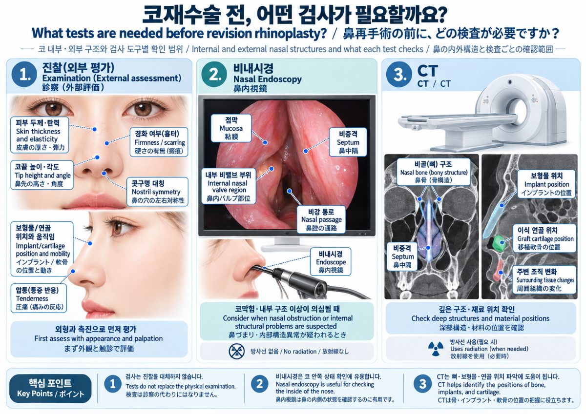 코재수술 전에 CT나 비내시경 검사가 필요한 경우는 언제인가요?