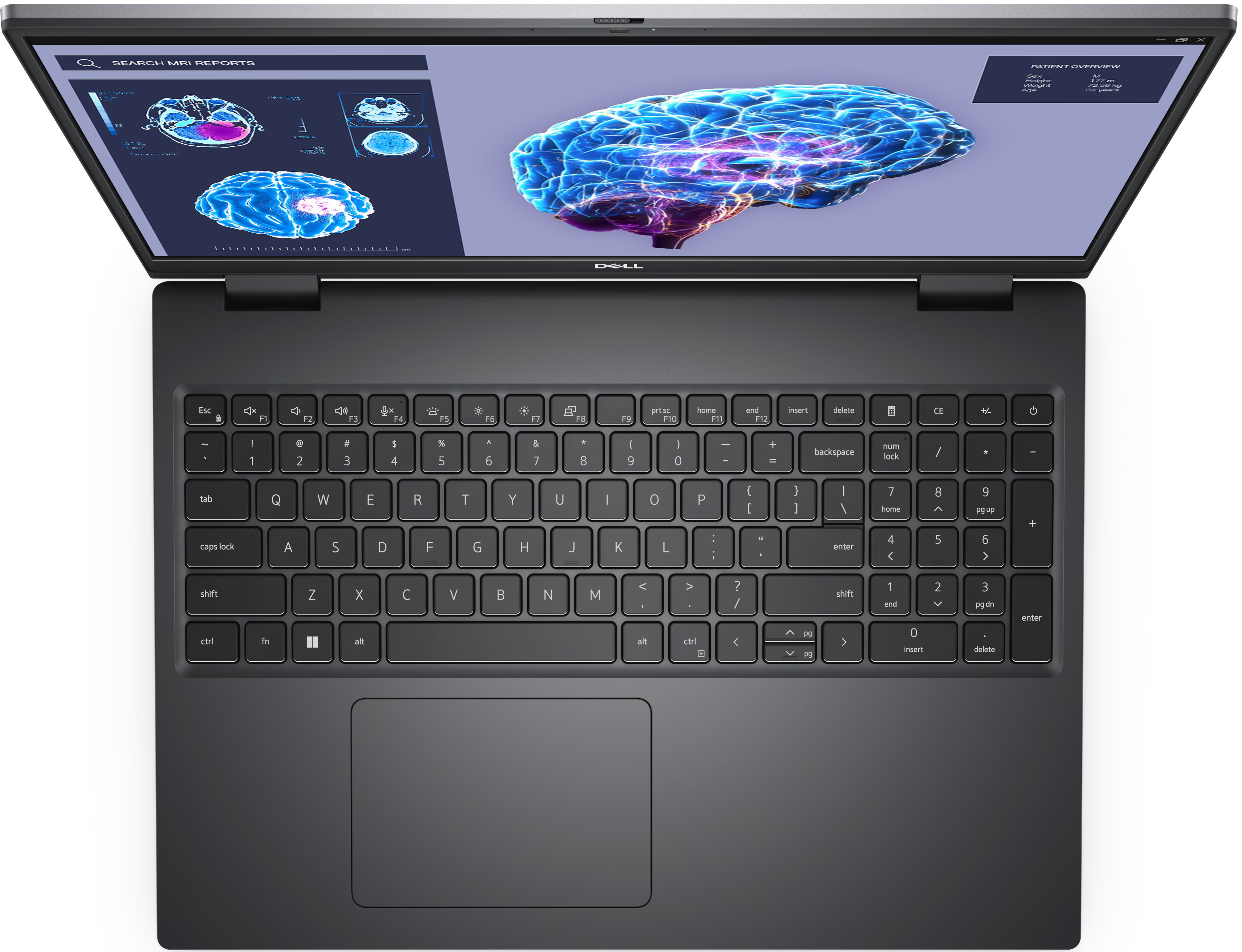 Laptop LAPTOP DELL PRECISION 7680 i7 13850HX RAM 32GB SSD 1TB RTX A1000 6GB